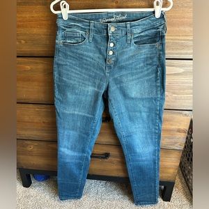 Button-fly skinny jeans